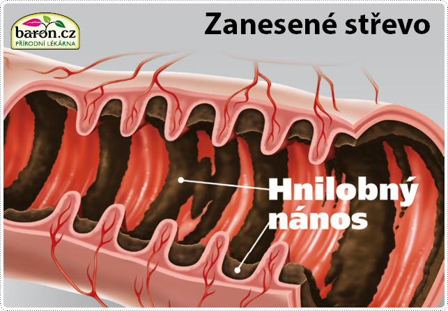 clanek-priciny-nemoci-lidi-zanesene-strevo-prirodni-lekarna-pro-lidi kopie